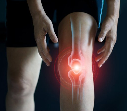 Sportif se tenant le genou, douleur de genou