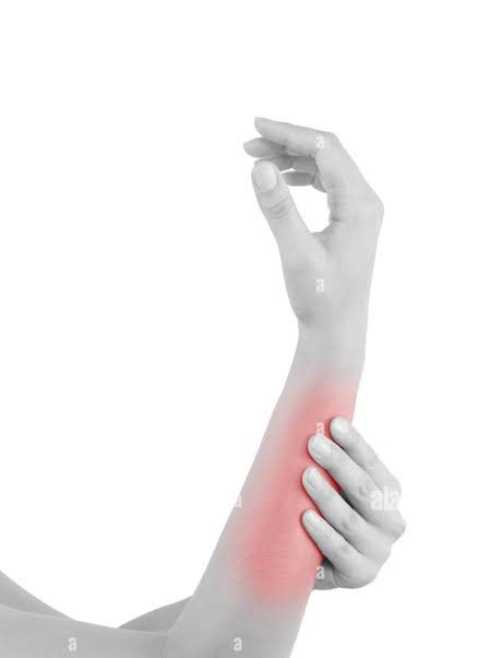 Sportif se tenant l'avant-bras, douleur d'avant-bras